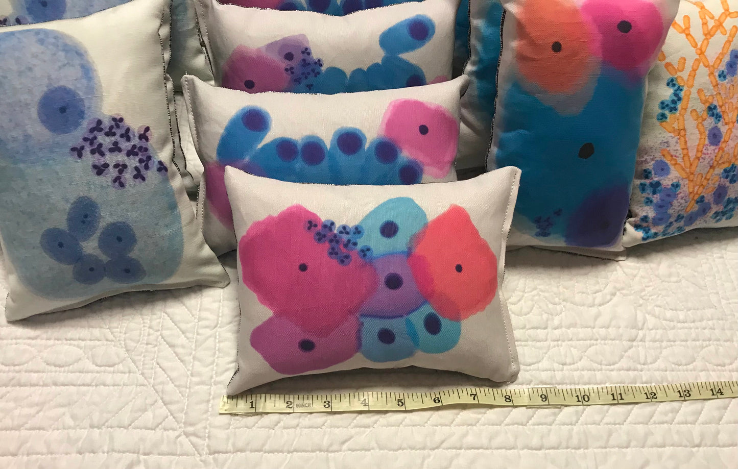 Benign Colorful Squamous cells Plushy