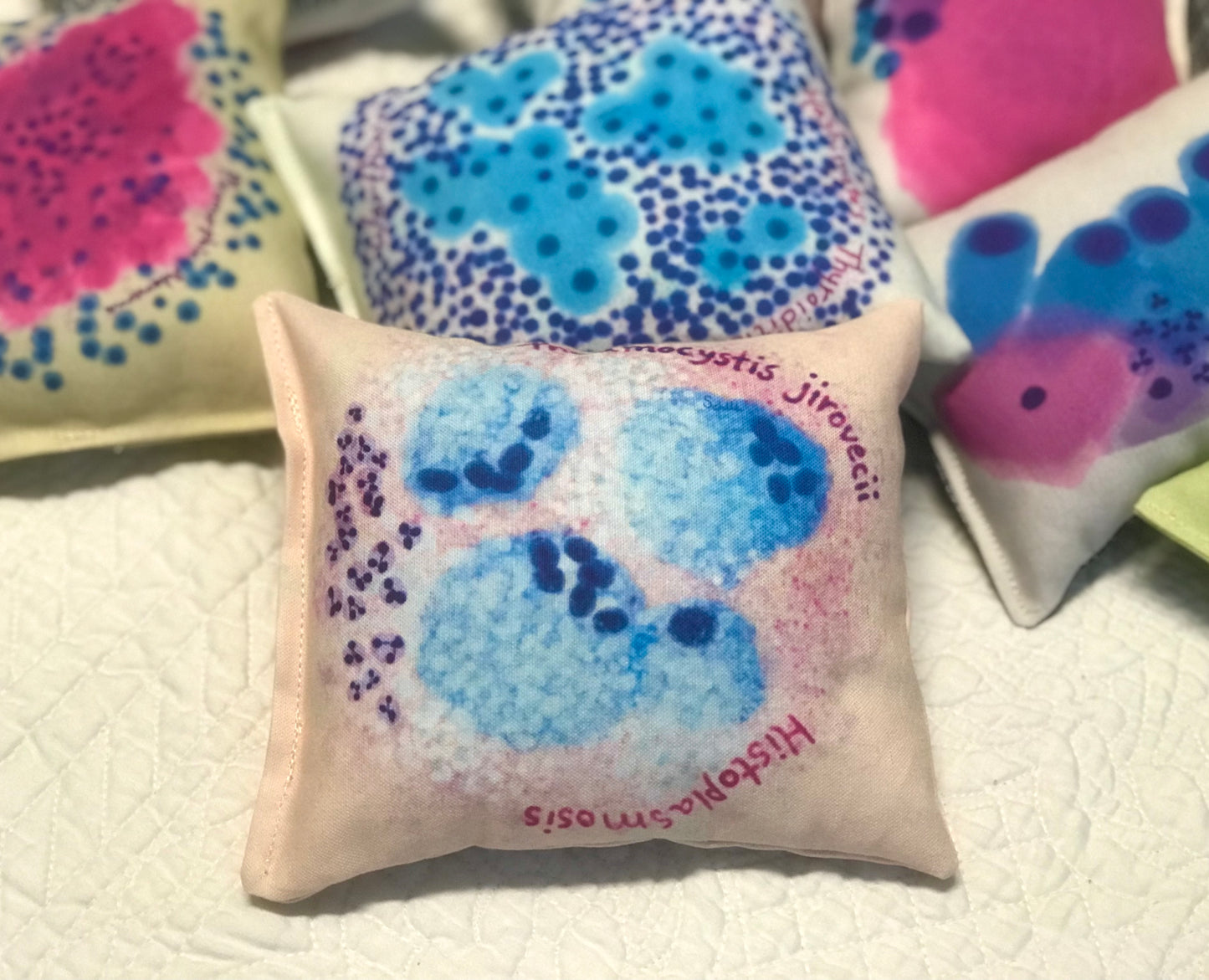 Histoplasmosis, Pneumo Plushy