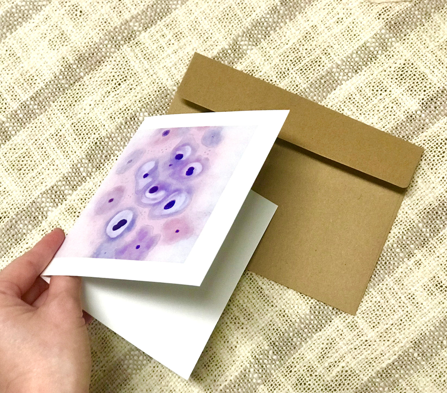 Dysplasia LSIL Squamous cells greeting cards
