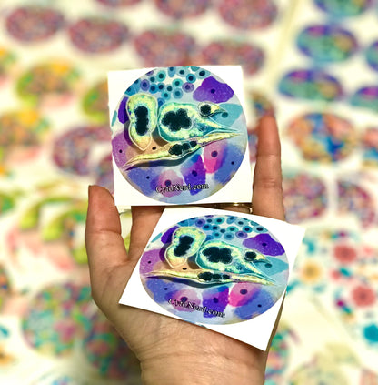 Dysplasia Stickers of colorful cells - High grade dysplasia