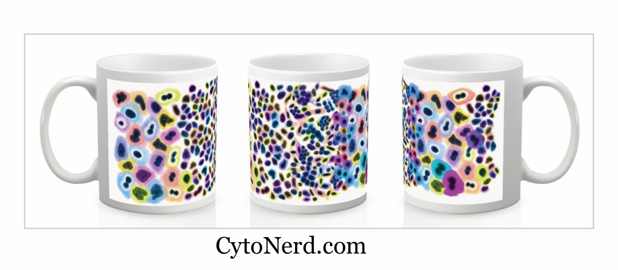 Mugs with abnormal cells from the cervix, coffee cup, ceramic cup with cells -  Dysplasia