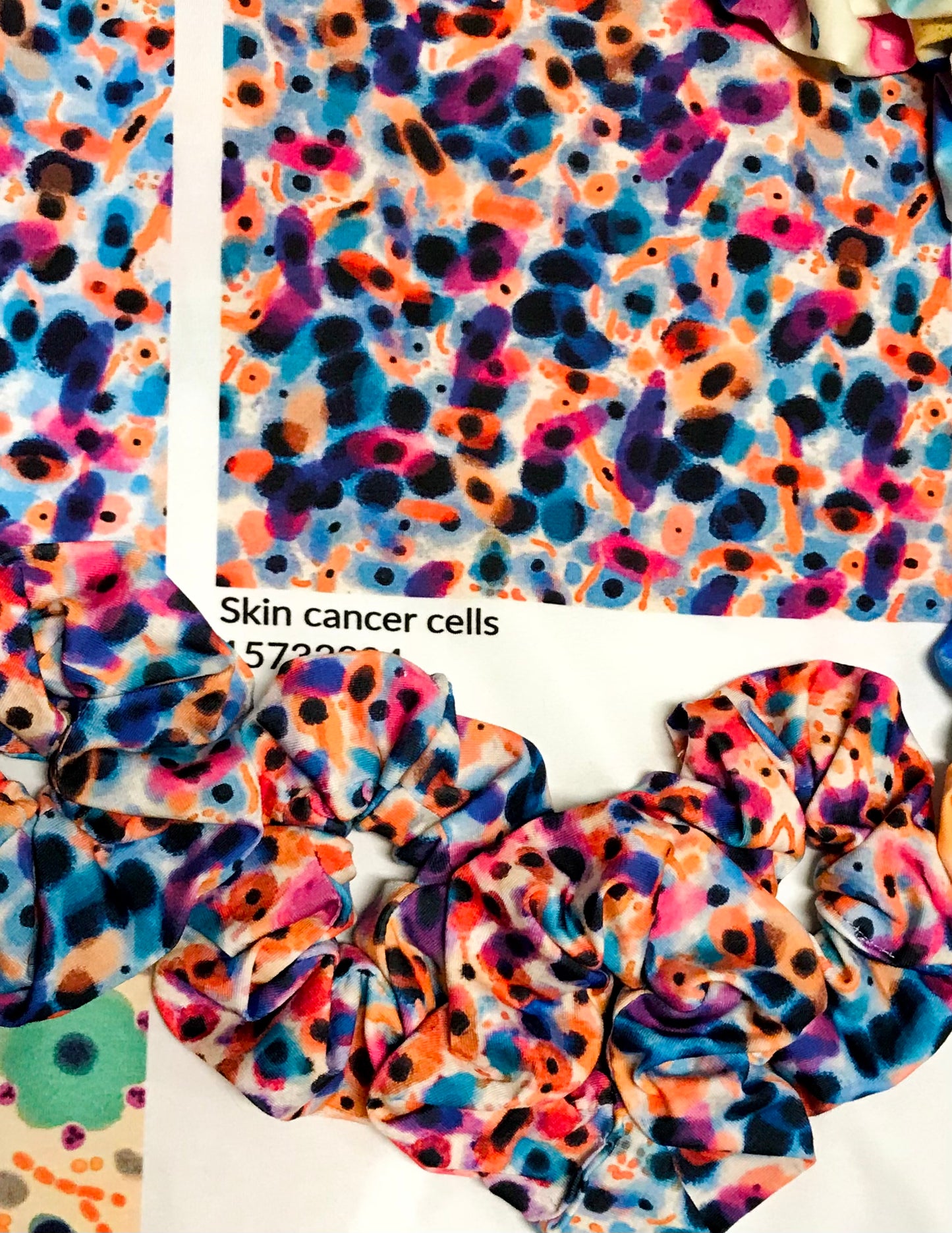 Skin cancer hair scrunchies - squamous cell carcinoma