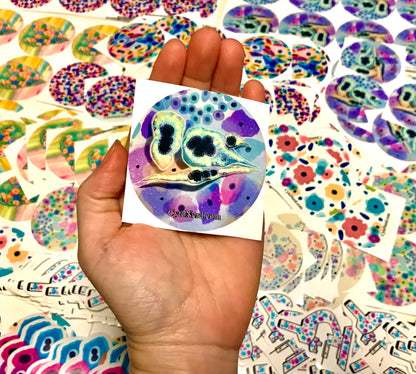 Dysplasia Stickers of colorful cells - High grade dysplasia