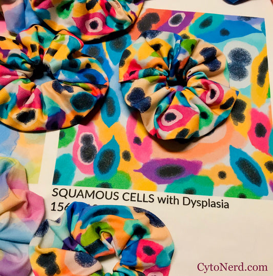 Hair scrunchies of Abnormal-Dysplasia cells