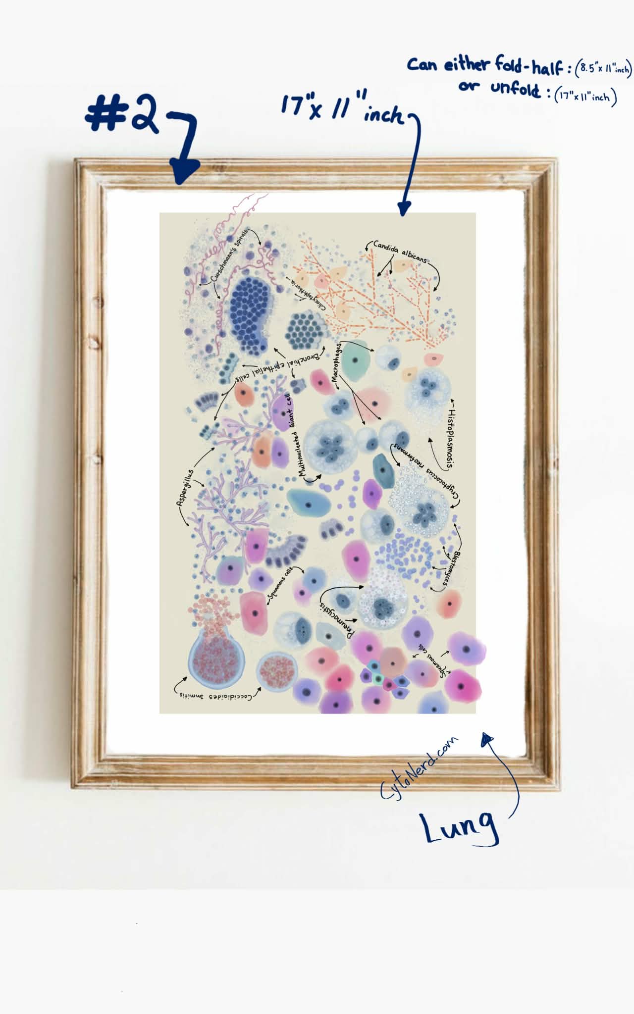 Posters - Large 11 x 17 “ inches study guide - fold-half is letter size or unfold for poster size - cytology pathology