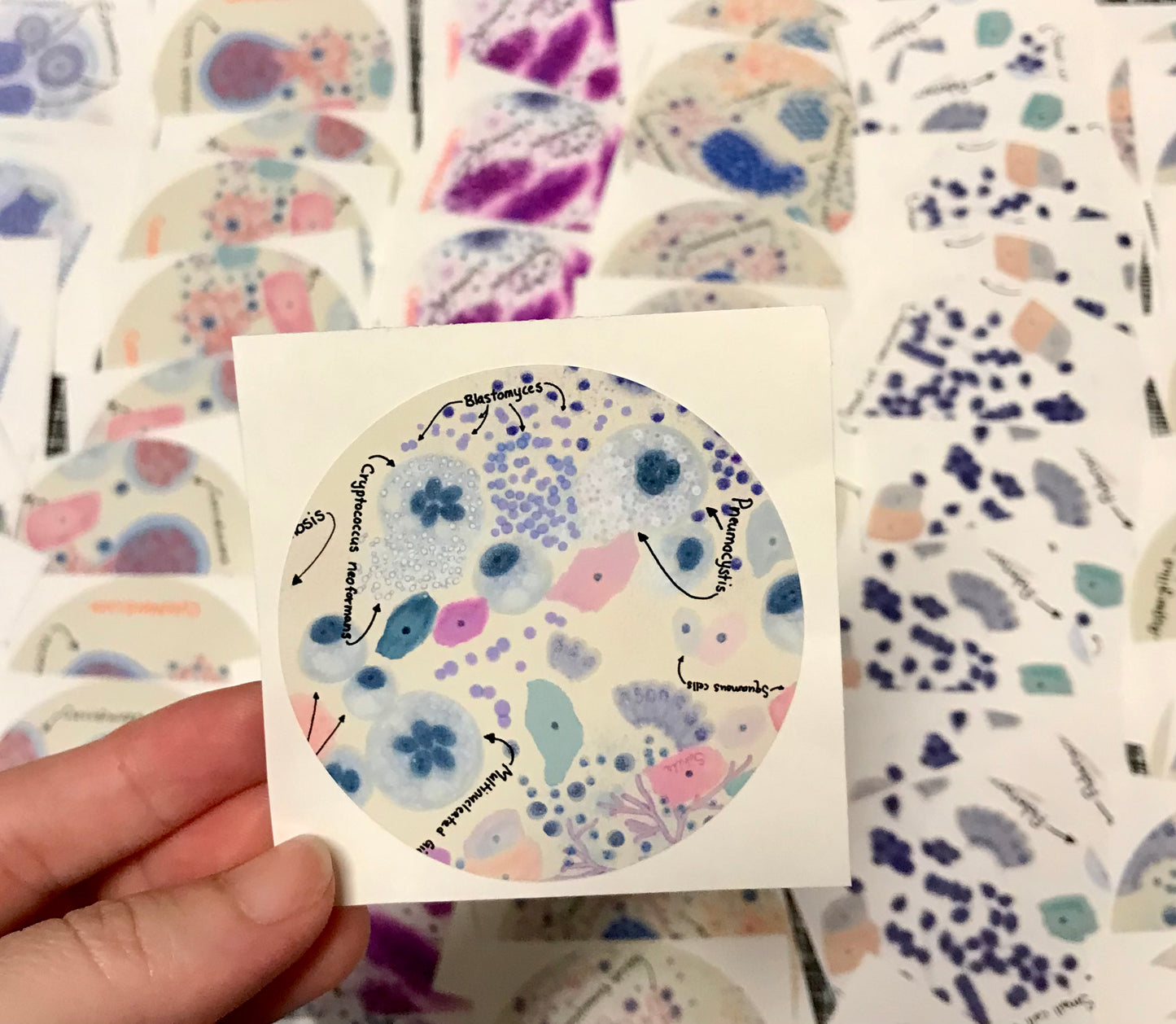 Pulmonary Infections Macrophages Histiocytes cells Stickers