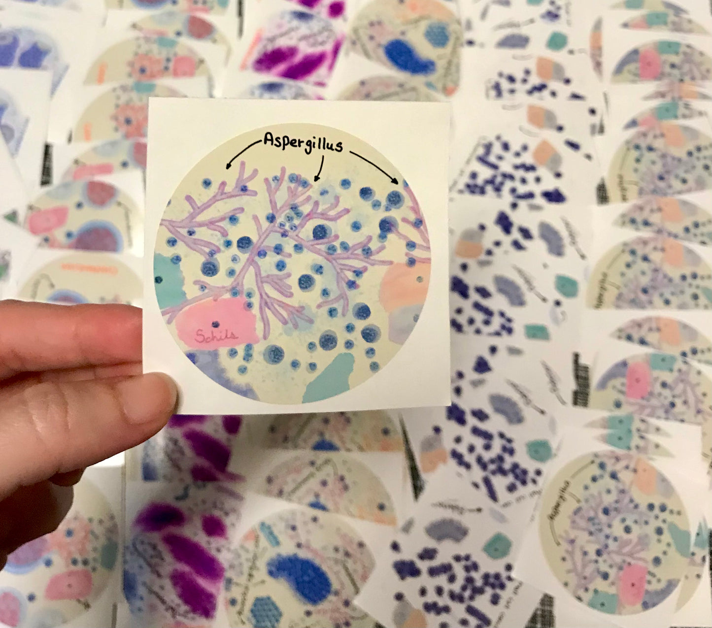 Aspergillus Pulmonary Infections cells Stickers