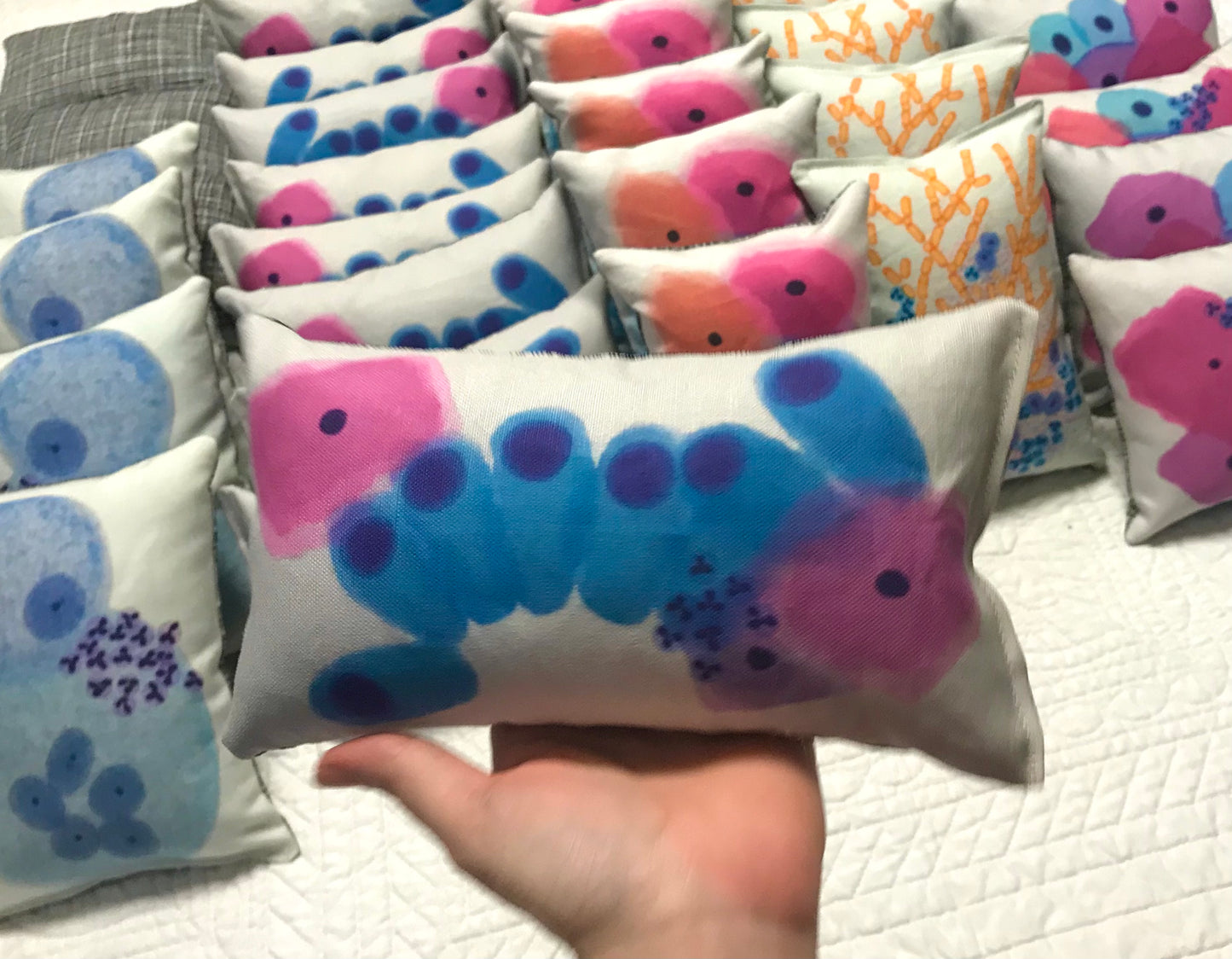 Benign Endocervical cells EC Squamous cells Plush pillow