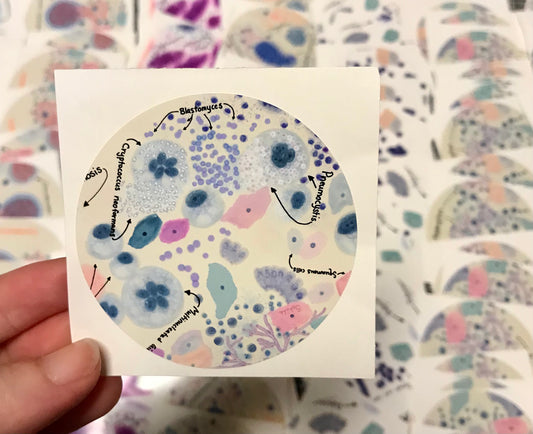 Pulmonary Infections Macrophages Histiocytes cells Stickers
