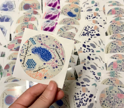 Benign lung bronchial cells Stickers