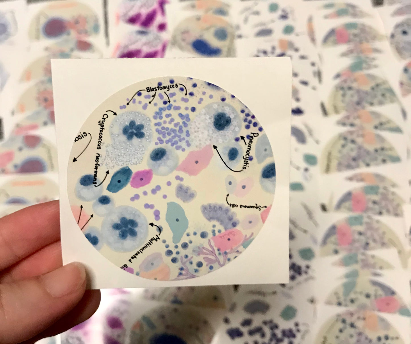 Pulmonary Infections Macrophages Histiocytes cells Stickers