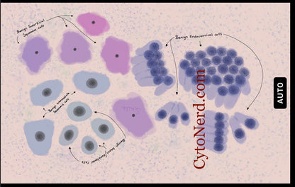 Pap Smear cells- Squamous cells poster, Cells art print, cancer colorful Cytology cells Pathology artwork posters prints