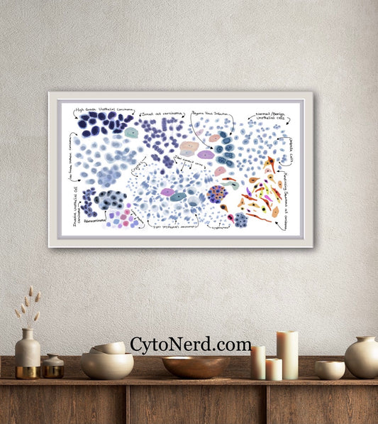 Urine Cells Poster, Urothelial cells, Bladder cancer art print, cancer colorful Cytology cells artwork