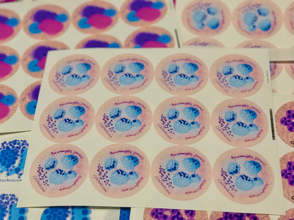 Pneumocystis and histoplasmosis Stickers