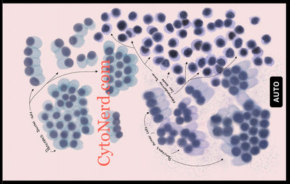 Pancreas Cells Poster, Acinar and ductal cells art print, cancer colorful Cytology cells Artwork