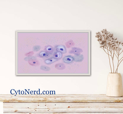 LSIL Squamous cells poster, Cells art print, cancer colorful Cytology cells Pathology artwork posters prints