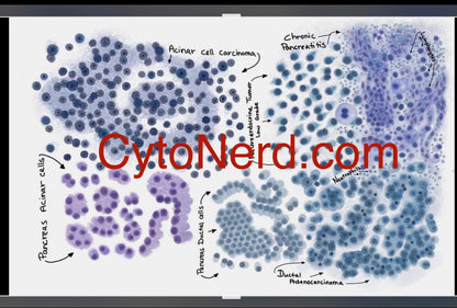 Pancreas Cells Poster, Acinar cells art print, cancer colorful Cytology cells Artwork