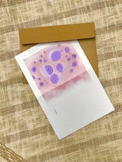 Adenocarcinoma cytology greeting cards