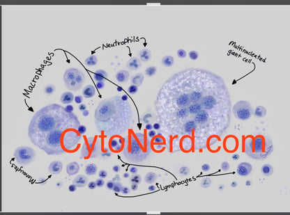 Macrophages Poster, reactive WBC Art print, Cytology cells, White blood cells artwork