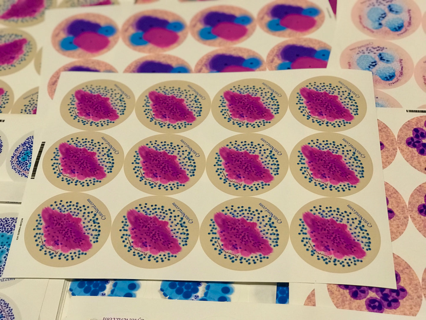 Pleomorphic Adenoma PA Stickers