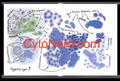 Liver art print Poster, liver cancer colorful Cytology cells artwork