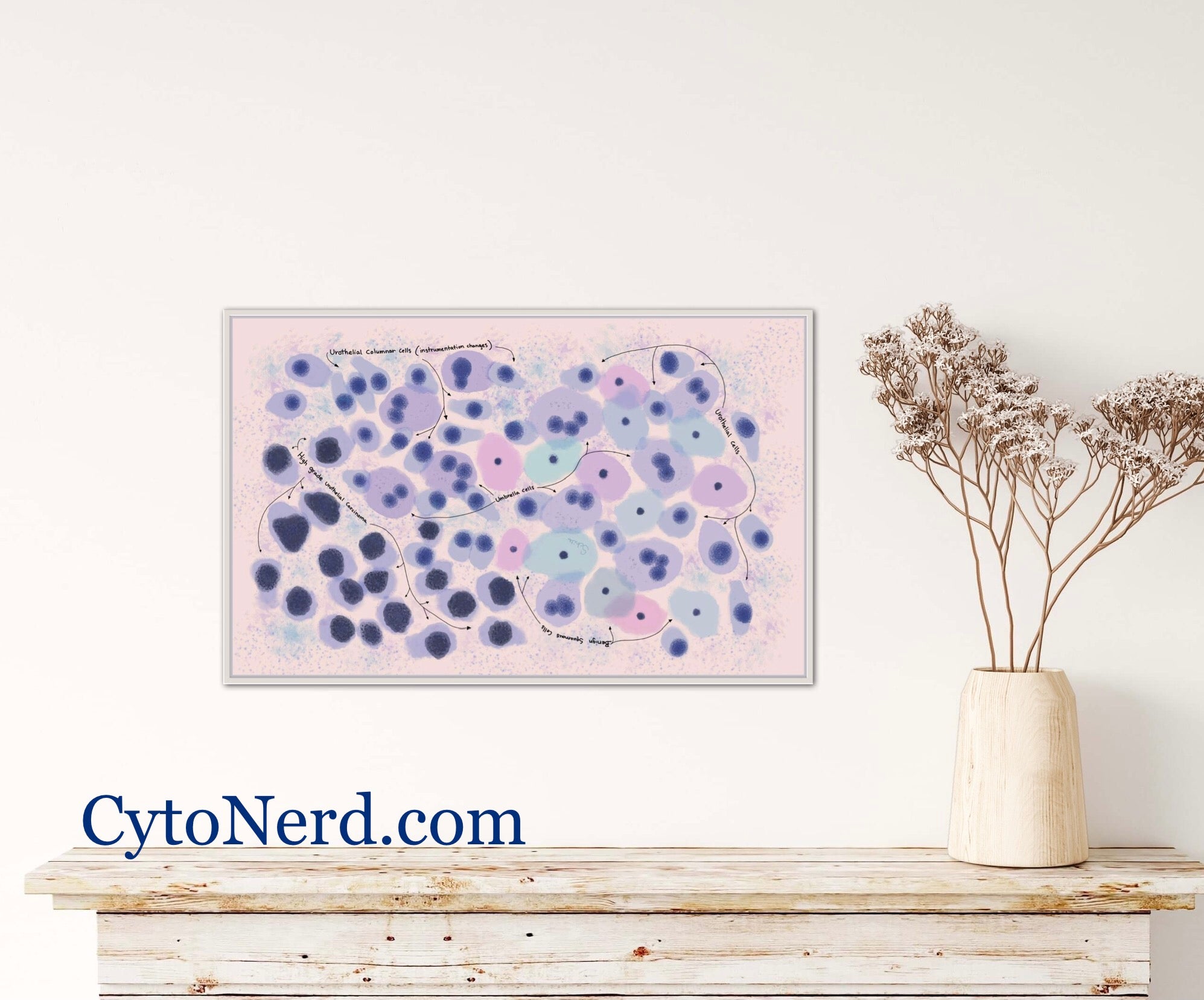 Cytology art prints, cells art prints, cells painting, pathology ...