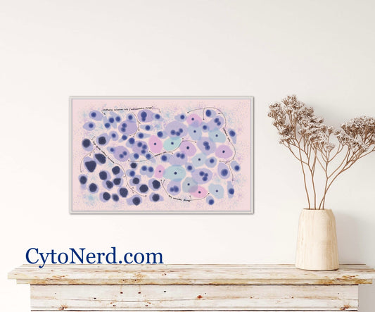 HGSIL - Urine Cells Poster, Urothelial cells, Bladder cancer art print, cancer colorful Cytology cells artwork