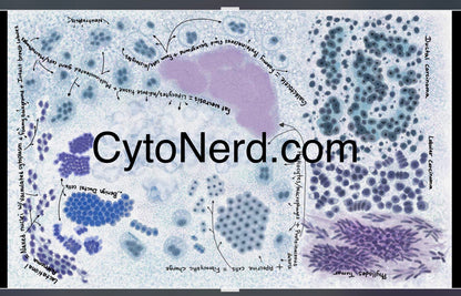 Cells poster, Breast Cytology Poster, breast cancer, colorful Cytology cells Art print