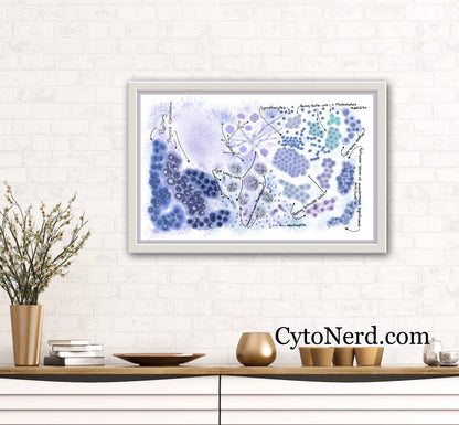 Thyroid art print Poster, Colloid Cytology cells, FLUS, follicular lesion, Hurtle cells