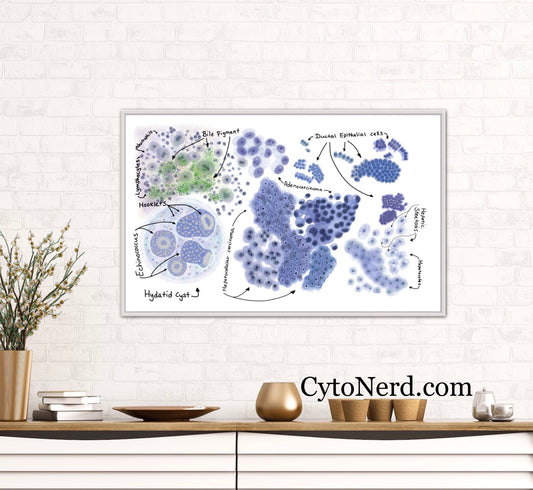Liver art print Poster, liver cancer colorful Cytology cells artwork