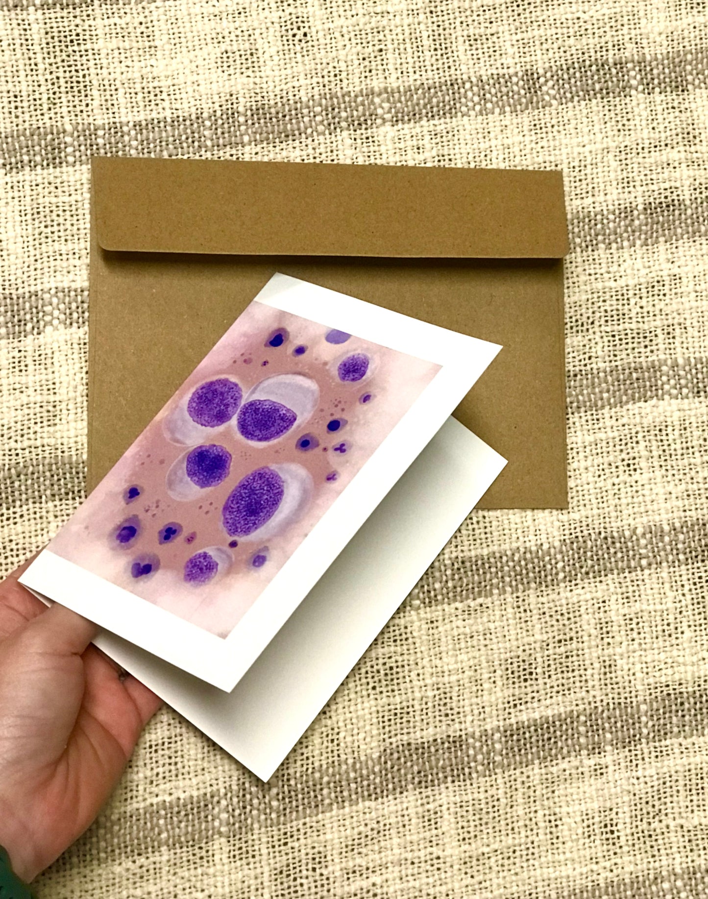 Adenocarcinoma cytology greeting cards