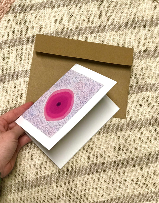 Pink squamous cells greeting cards