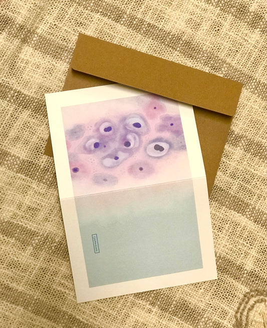 Dysplasia LSIL Squamous cells greeting cards