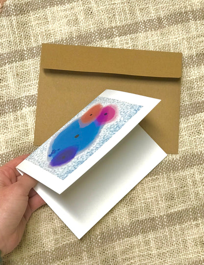 Benign Squamous cells greeting cards