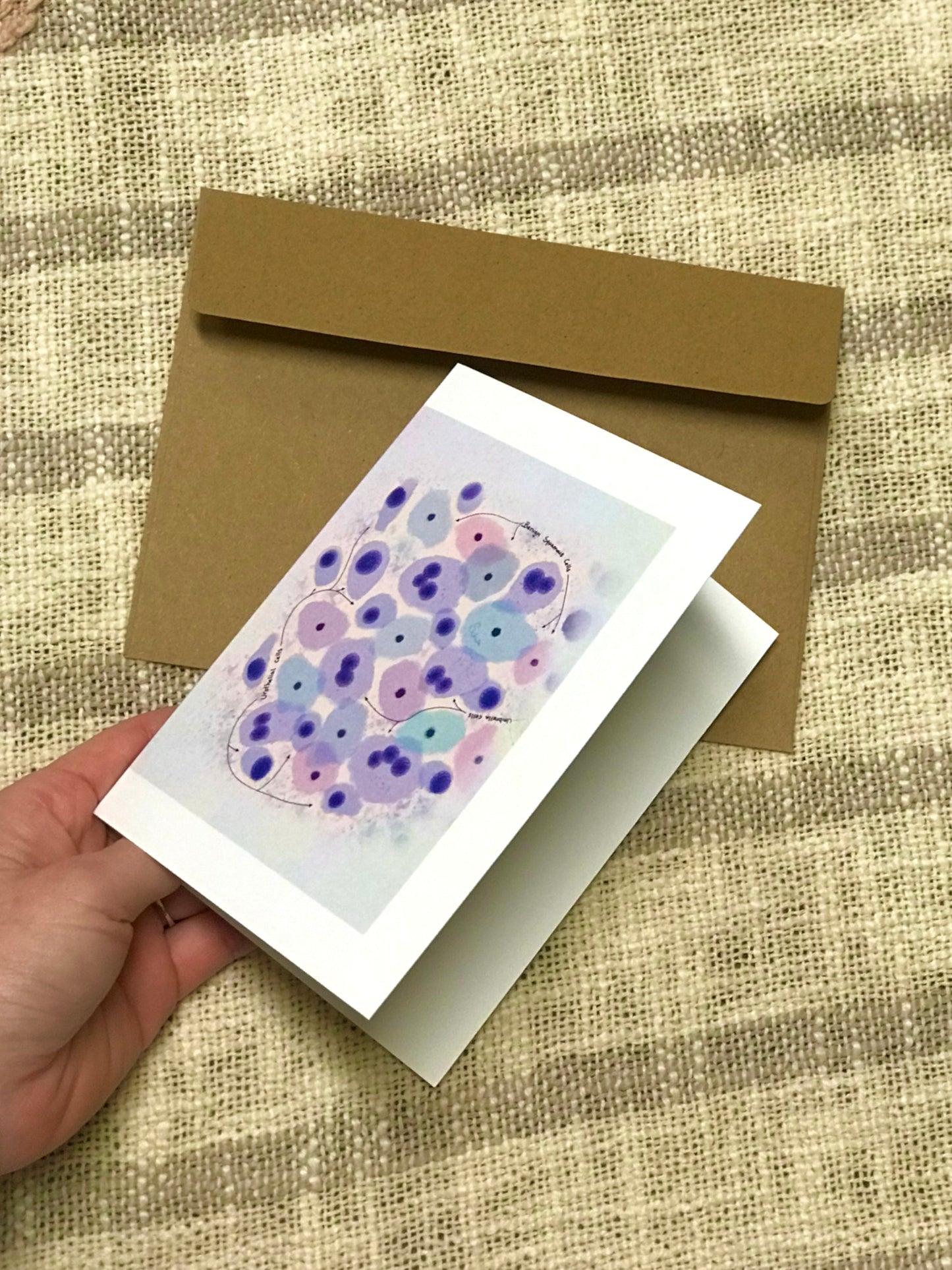 Benign Urine cytology greeting cards