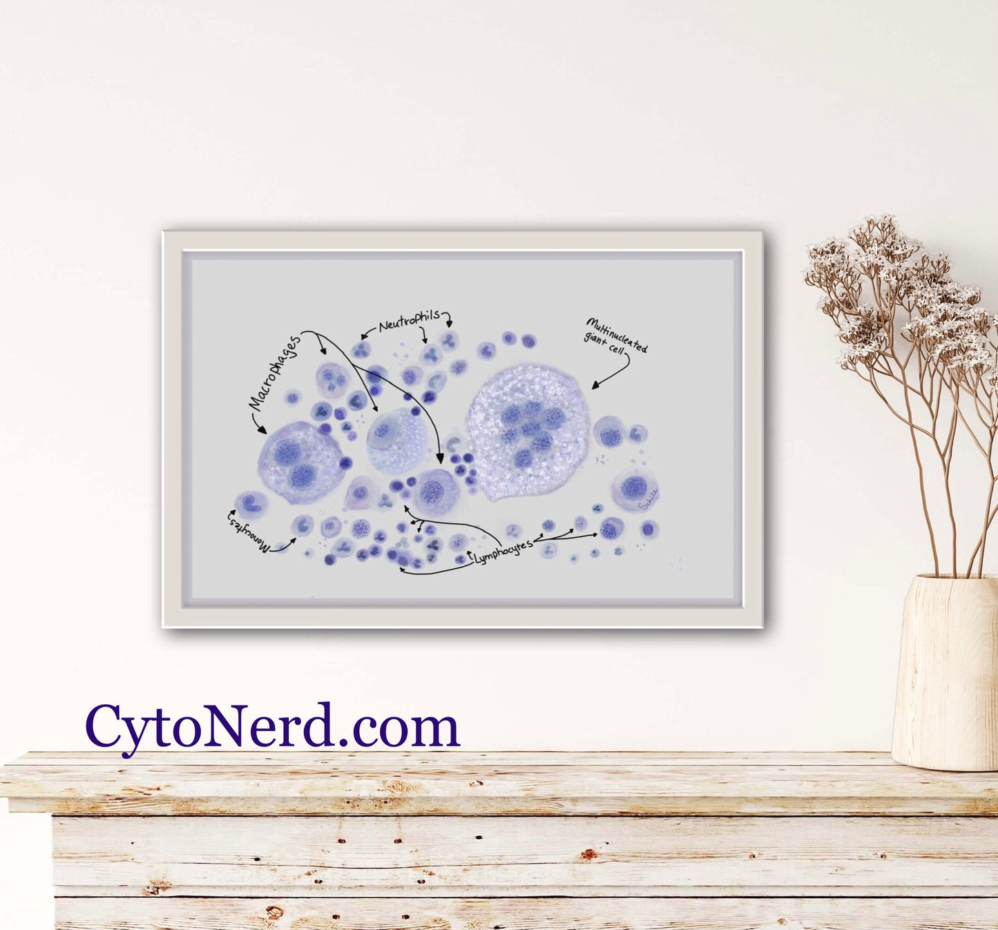 Macrophages Poster, reactive WBC Art print, Cytology cells, White blood cells artwork