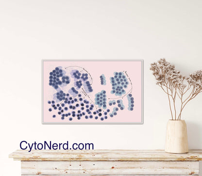 Pancreas Cells Poster, Acinar and ductal cells art print, cancer colorful Cytology cells Artwork